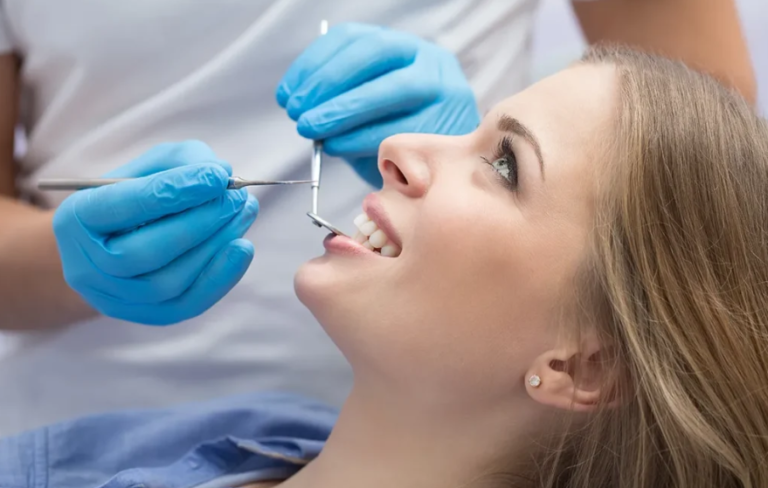 Why Your Old Fillings Might Be Silently Failing